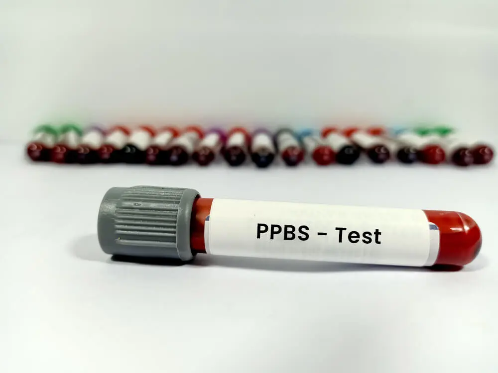 PPBS test