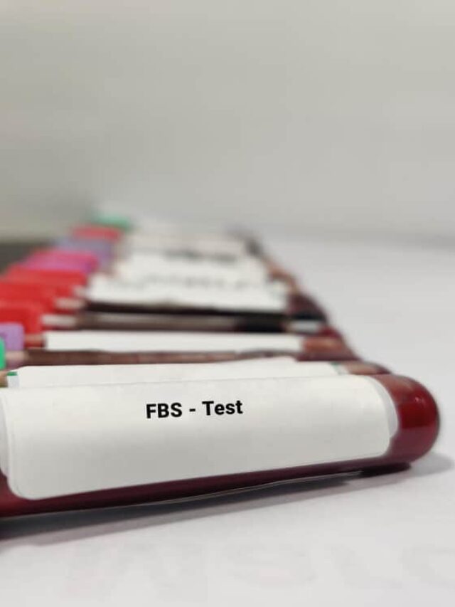 Fasting Blood Sugar Test (FBS Test)