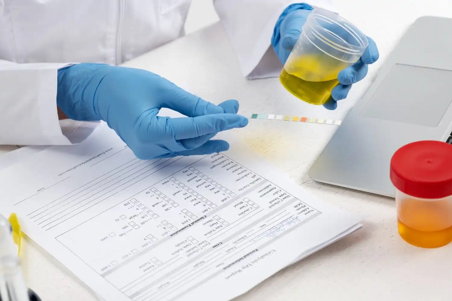 lab doctor performing medical exam urine