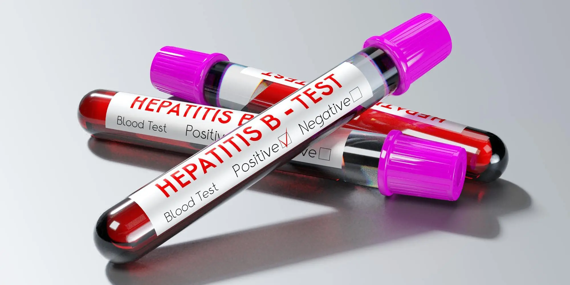 hepatitis b virus test tubes blood tests